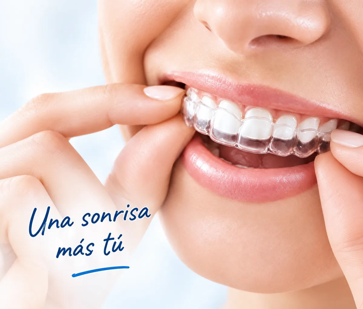 Mujer colocándose un alineador transparente
